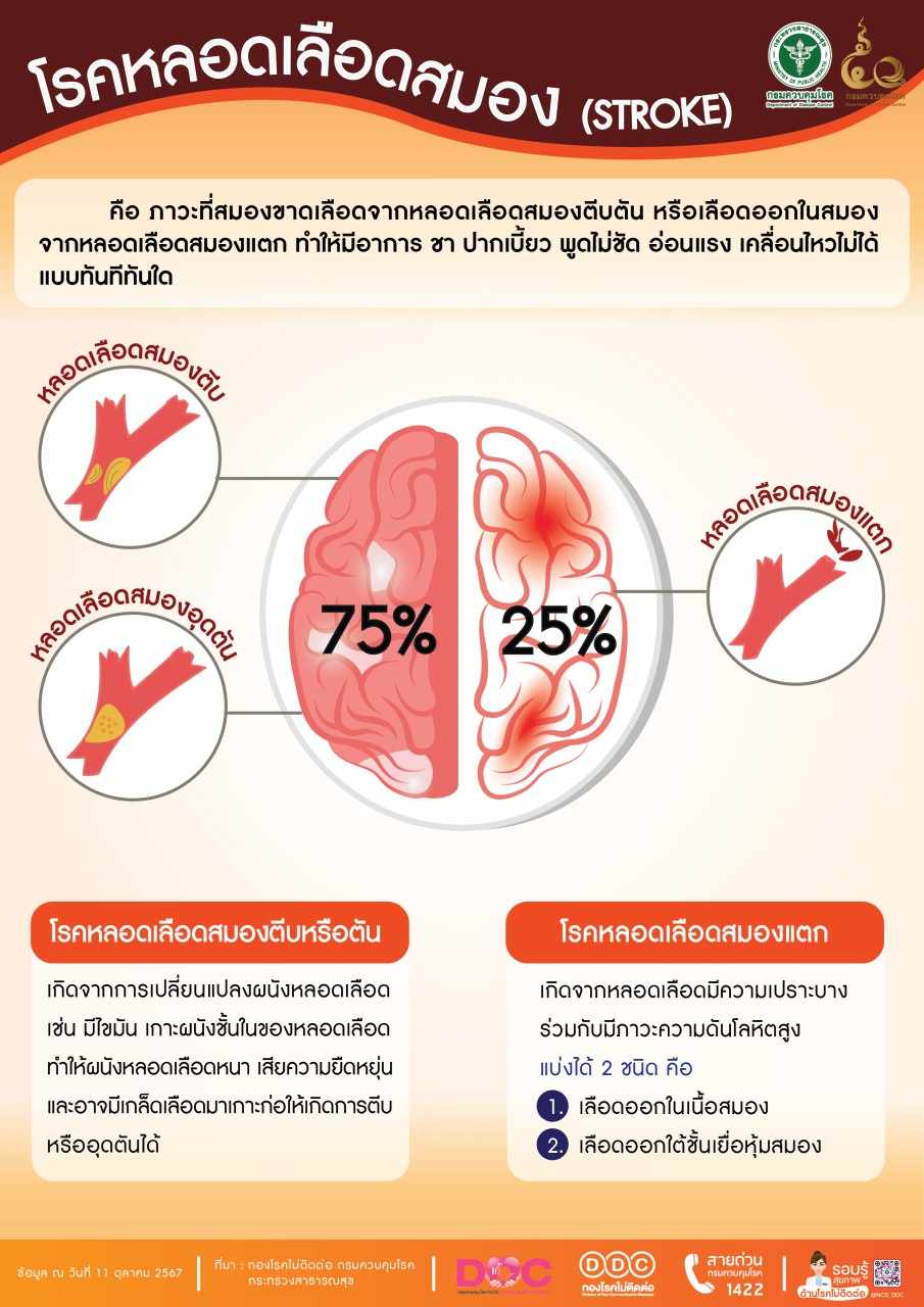 โรคหลอดเลือดสมอง STROKE