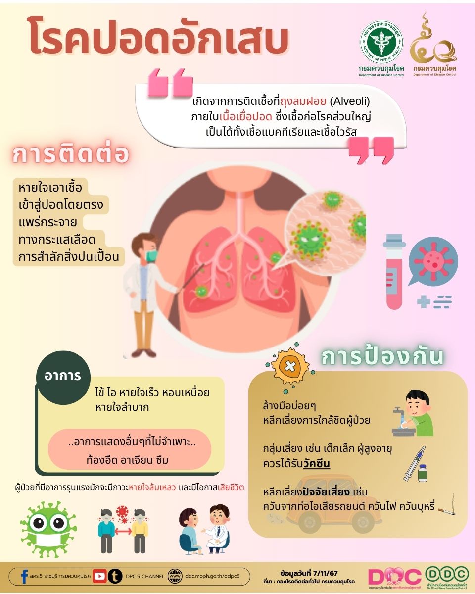 โรคปอดอักเสบ