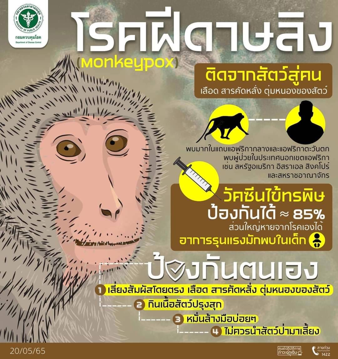 โรคฝีดาษลิง Monkey pox